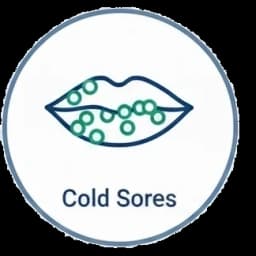 Cold Sores