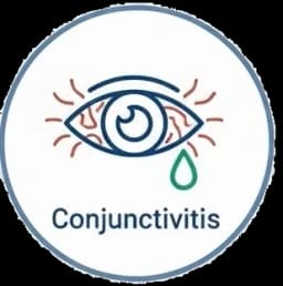 Conjunctivitis