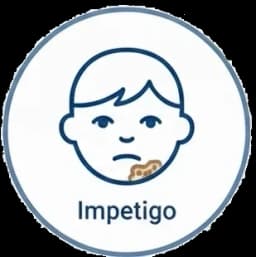 Impetigo