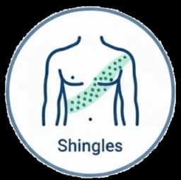 Shingles